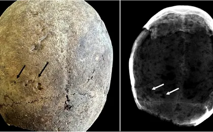 cercetatorii au gasit cocaina in cadavre din secolul 17 66d7fab1c287f