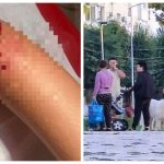 socant un copil a fost atacat de un caine fara botnita in parcul evergreen din mangalia 66e58f705a91e