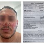 galerie foto ancheta la murfatlar dupa ce un angajat care taia butelii a fost victima unei explozii mama acestuia ar fi lovit o pe patroana 66fdc8e3abe64