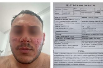 galerie foto ancheta la murfatlar dupa ce un angajat care taia butelii a fost victima unei explozii mama acestuia ar fi lovit o pe patroana 66fdc8e3abe64